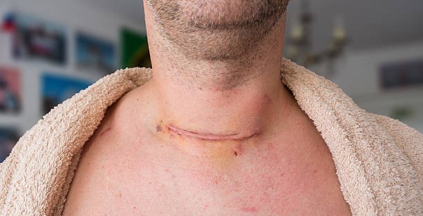 Doctor For Thyroid Surgery In Ghatkopar